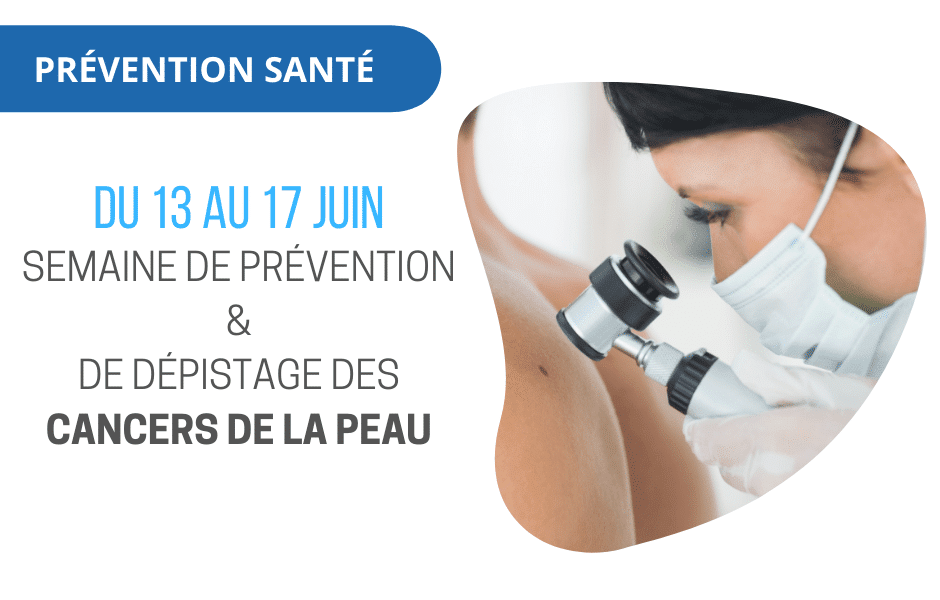 prévention cancer de la peau